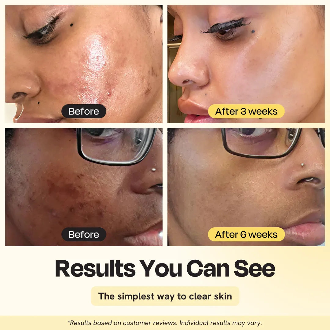 Jumbo Vitamin C Clay Mask